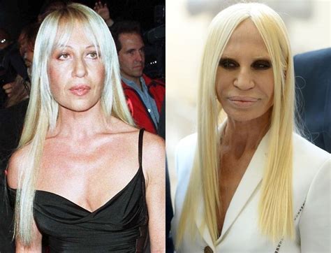 donatella versace before after|donatella versace most famous moments.